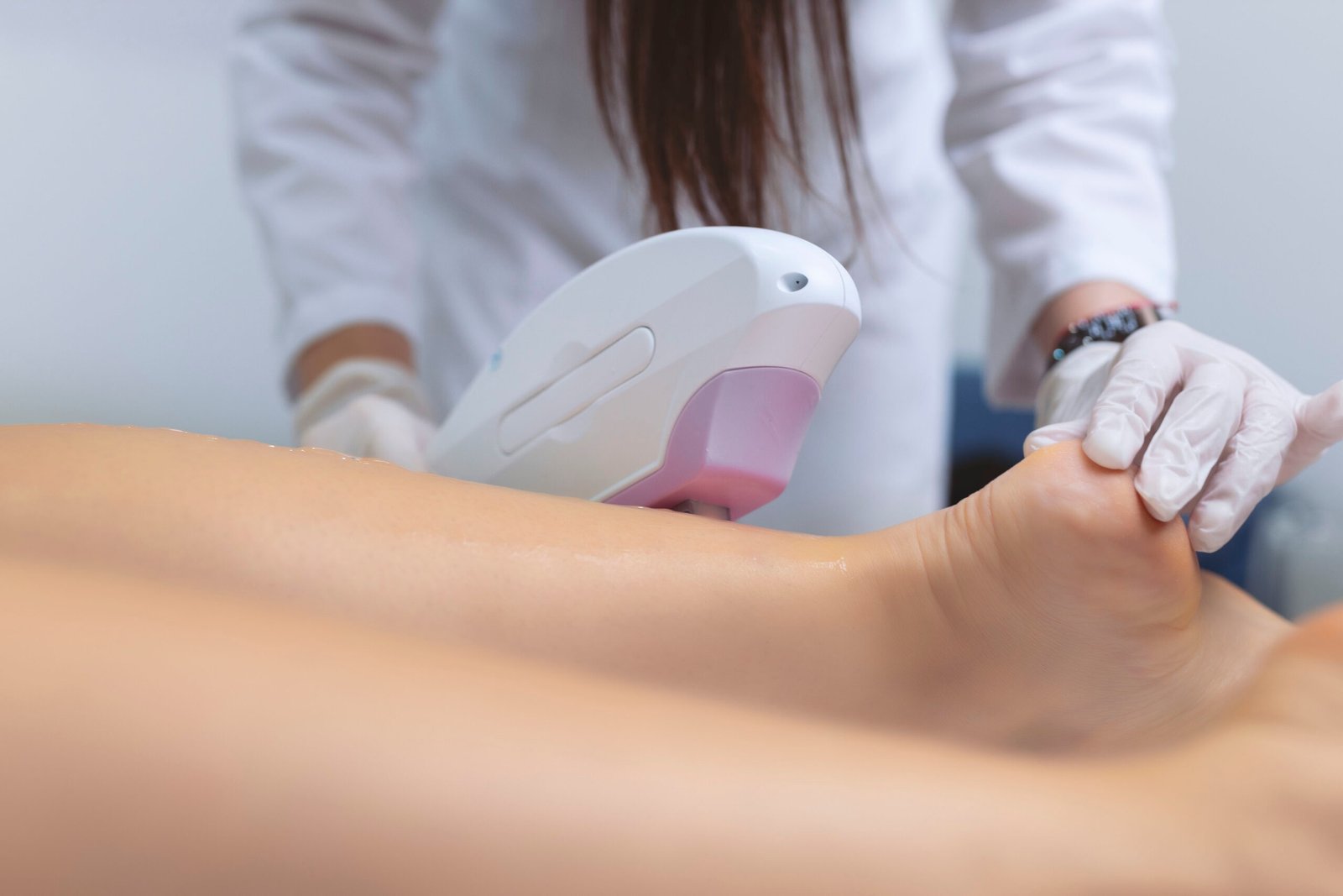 depilación facial con láser